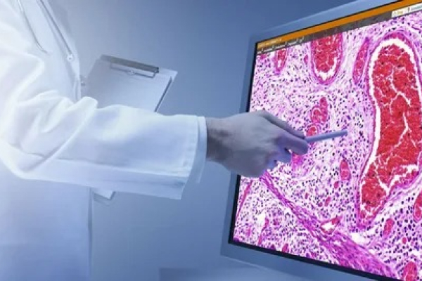 Как защитить себя от онкологии с помощью ОМС